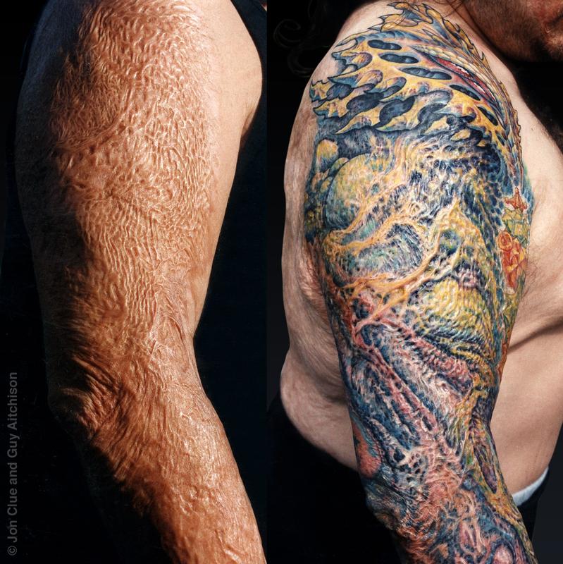 Guy Aitchison : Tattoos : Collaborative : Anthony (burn scar coverup), Collaboration by Jon Clue and Guy Aitchison