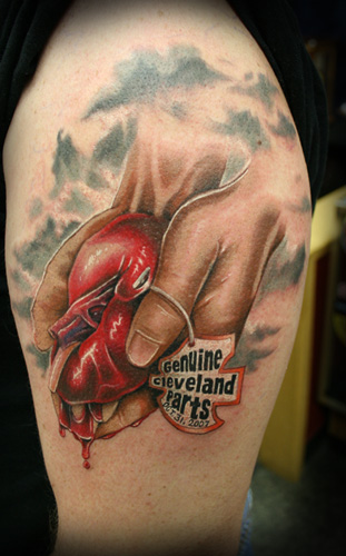 Kidney Tattoos American Journal of Kidney Diseases  ppt download