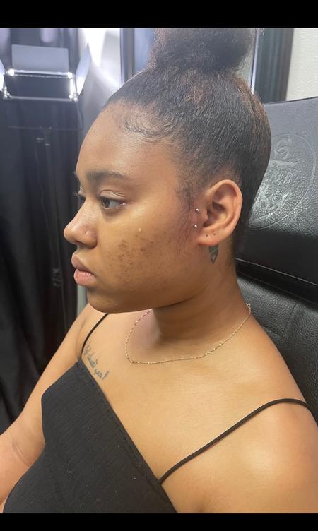 Jen Ayers (WOODLANDS TX) - Anti tragus