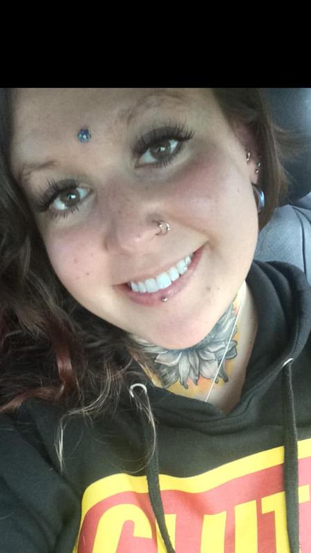 Jen Ayers (WOODLANDS TX) - Dermal