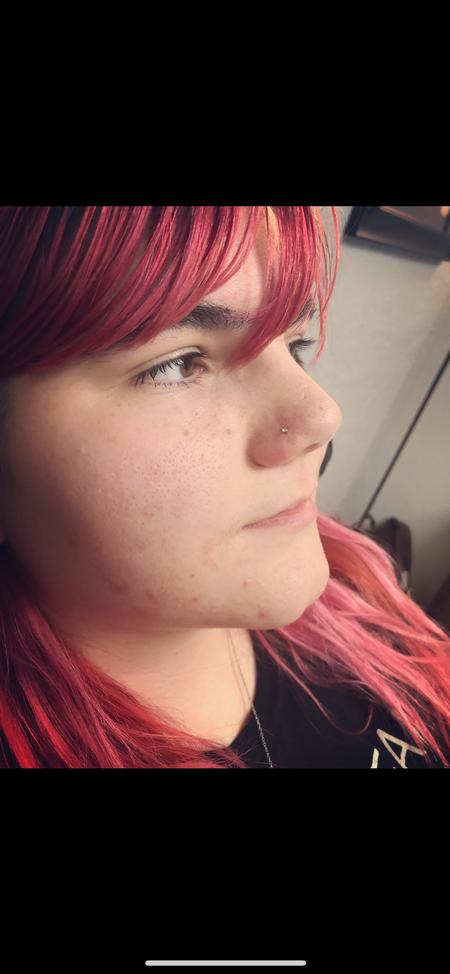 Jen Ayers (WOODLANDS TX) - Nostril