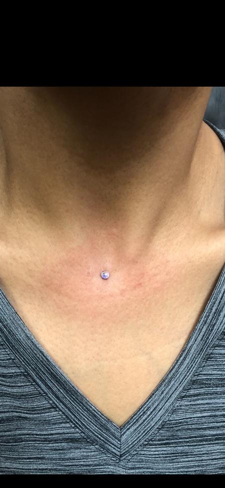 Jen Ayers (WOODLANDS TX) - Dermal