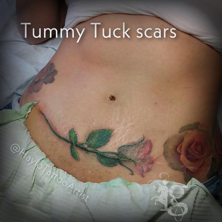 Tummy tuck scar tattoo